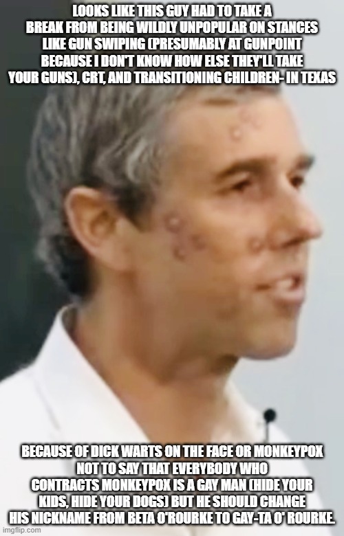 Gay-ta O' Rourke | LOOKS LIKE THIS GUY HAD TO TAKE A BREAK FROM BEING WILDLY UNPOPULAR ON STANCES LIKE GUN SWIPING (PRESUMABLY AT GUNPOINT BECAUSE I DON'T KNOW HOW ELSE THEY'LL TAKE YOUR GUNS), CRT, AND TRANSITIONING CHILDREN- IN TEXAS; BECAUSE OF DICK WARTS ON THE FACE OR MONKEYPOX
NOT TO SAY THAT EVERYBODY WHO CONTRACTS MONKEYPOX IS A GAY MAN (HIDE YOUR KIDS, HIDE YOUR DOGS) BUT HE SHOULD CHANGE HIS NICKNAME FROM BETA O'ROURKE TO GAY-TA O' ROURKE. | image tagged in beto monkeypox | made w/ Imgflip meme maker