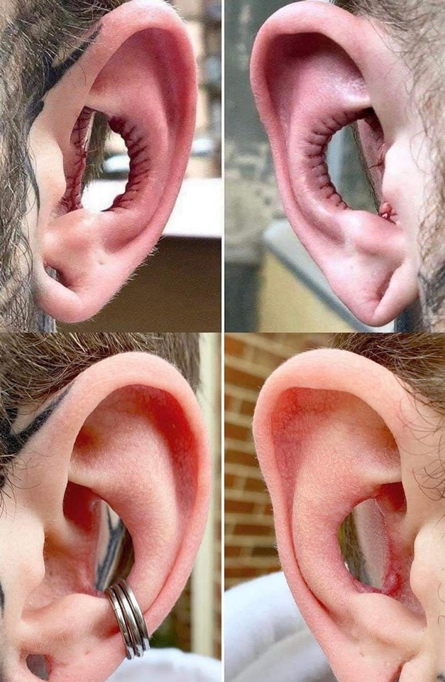 I bet this idiot can't hear for shit! | image tagged in piercings,body piercings,morons | made w/ Imgflip meme maker