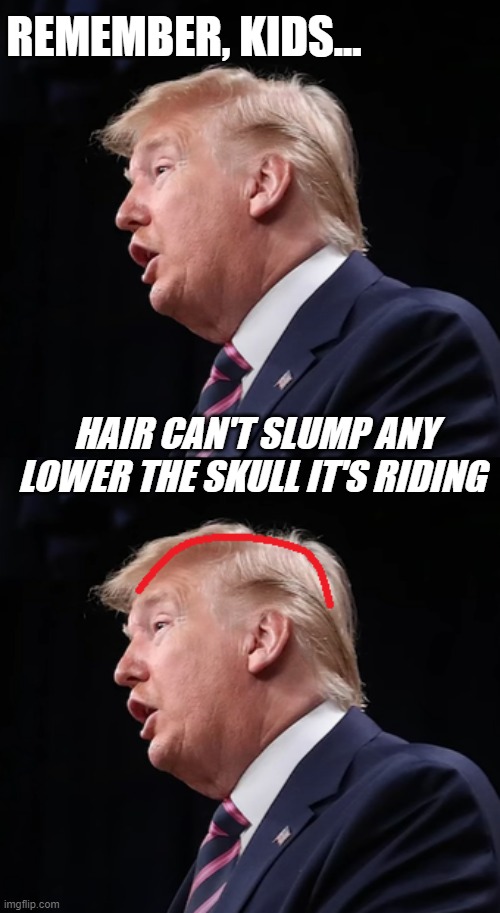 microcephaly | REMEMBER, KIDS... HAIR CAN'T SLUMP ANY LOWER THE SKULL IT'S RIDING | image tagged in microcephaly | made w/ Imgflip meme maker