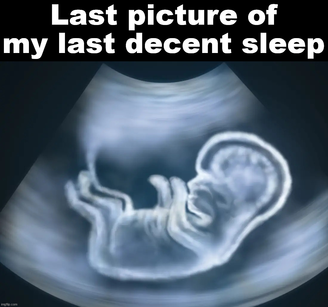 I would like more than 5 hours of sleep | Last picture of my last decent sleep | image tagged in ultrasound,sleeping | made w/ Imgflip meme maker