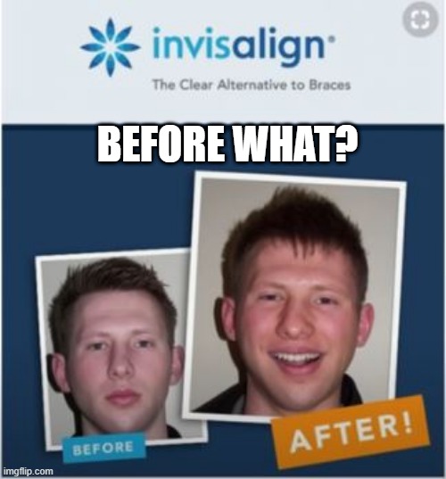Did He Even Have Bad Teeth? | BEFORE WHAT? | image tagged in you had one job | made w/ Imgflip meme maker