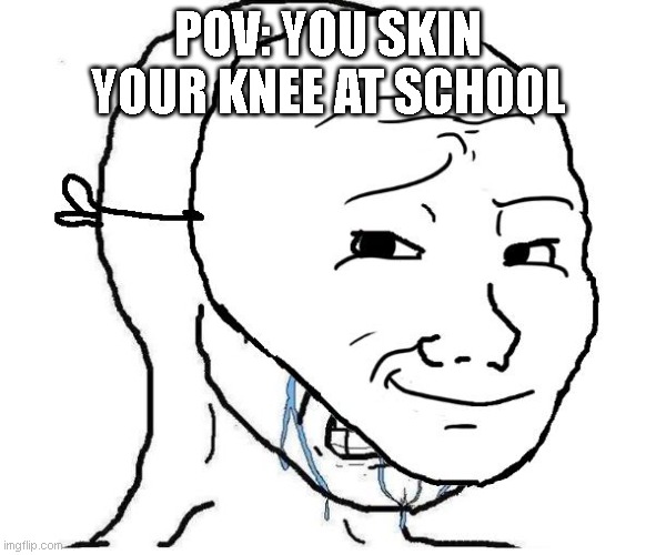 We gotta hold em in | POV: YOU SKIN YOUR KNEE AT SCHOOL | image tagged in cry behind mask,memes,meme,funny memes,funny meme,funny | made w/ Imgflip meme maker