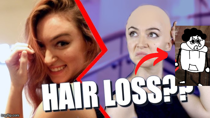 GUYS ITS HAIR LOSS FROM THE HIT IMGFLIP STREAM MS_MEMER_GROUP | made w/ Imgflip meme maker