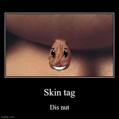 Skintag | image tagged in funny,demotivationals,skiin,tag,roblox | made w/ Imgflip demotivational maker