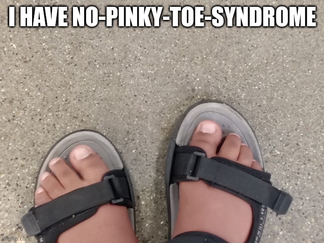 My toes disappeared magically | I HAVE NO-PINKY-TOE-SYNDROME | image tagged in toes | made w/ Imgflip meme maker