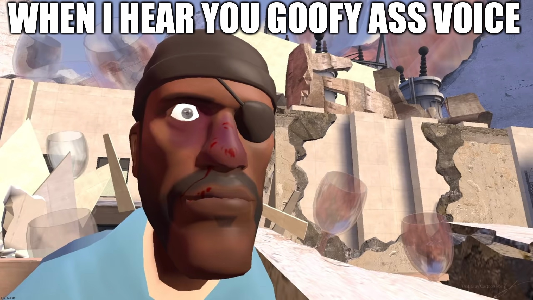 You are goofy | WHEN I HEAR YOU GOOFY ASS VOICE | image tagged in goofy | made w/ Imgflip meme maker