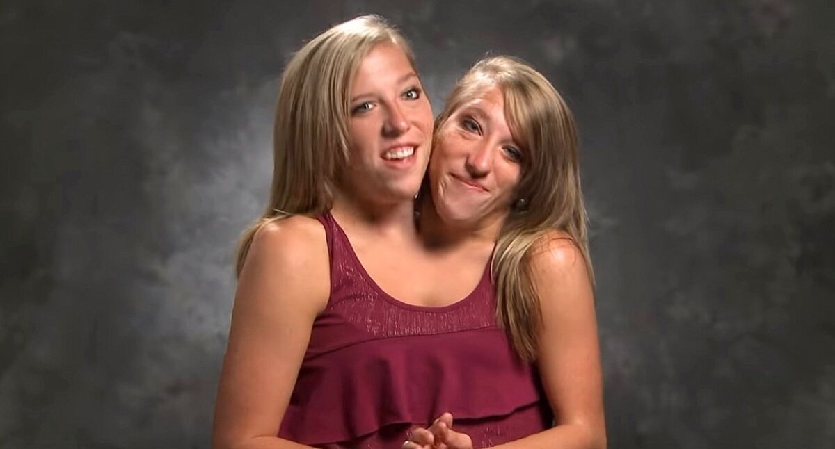 abby and brittany hensel Blank Meme Template