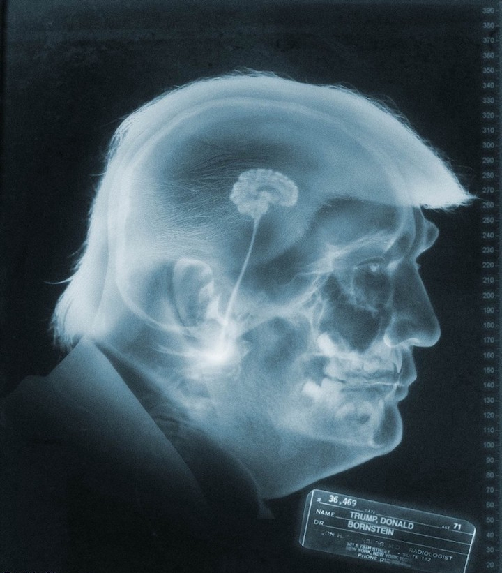 trump's brain Blank Meme Template