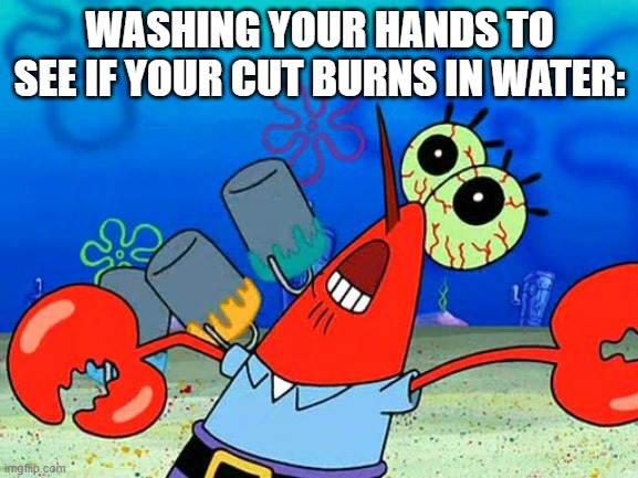 Water Wailer | WASHING YOUR HANDS TO SEE IF YOUR CUT BURNS IN WATER: | image tagged in oww my dolphin noise foot | made w/ Imgflip meme maker