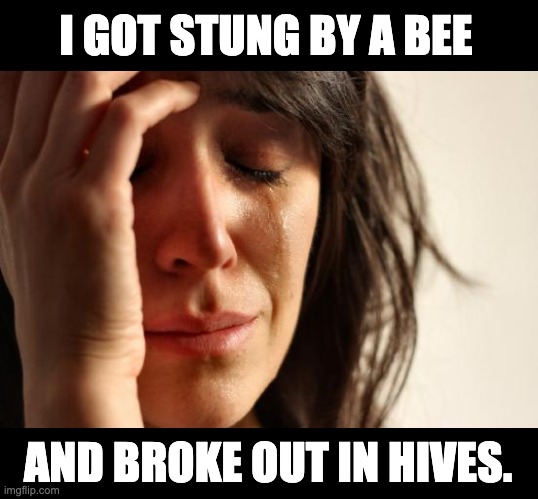 Bee | I GOT STUNG BY A BEE; AND BROKE OUT IN HIVES. | image tagged in memes,first world problems | made w/ Imgflip meme maker
