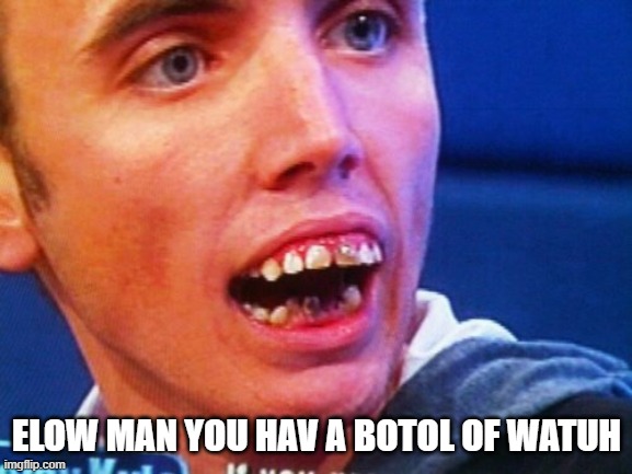 British Teeth  | ELOW MAN YOU HAV A BOTOL OF WATUH | image tagged in british teeth | made w/ Imgflip meme maker