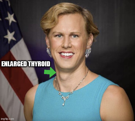 guy | ENLARGED THYROID | image tagged in guy | made w/ Imgflip meme maker