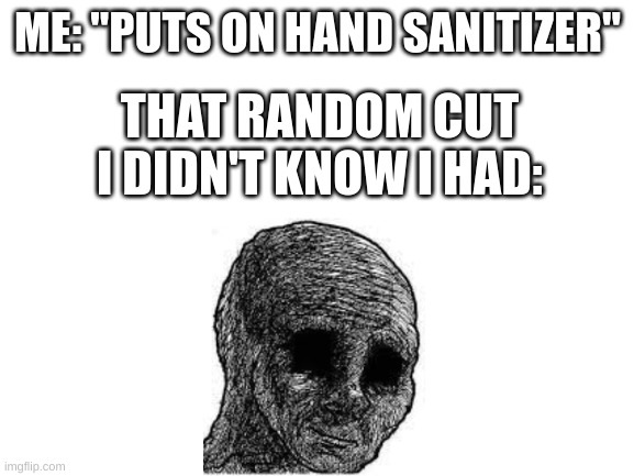 Blank White Template |  ME: "PUTS ON HAND SANITIZER"; THAT RANDOM CUT I DIDN'T KNOW I HAD: | image tagged in blank white template,funny,fun,hand sanitizer,lol | made w/ Imgflip meme maker