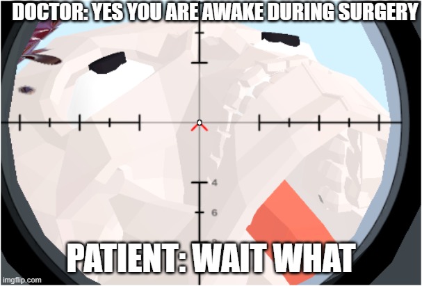Yes you are awake | DOCTOR: YES YOU ARE AWAKE DURING SURGERY; PATIENT: WAIT WHAT | image tagged in memes,funny memes,skeleton | made w/ Imgflip meme maker