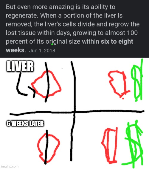 Rich, rich I tell ya | LIVER; 6 WEEKS LATER | image tagged in blank white template | made w/ Imgflip meme maker