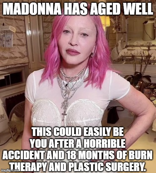 cheap shot, yes, but cheaper than all those surgeries | MADONNA HAS AGED WELL; THIS COULD EASILY BE YOU AFTER A HORRIBLE ACCIDENT AND 18 MONTHS OF BURN THERAPY AND PLASTIC SURGERY. | image tagged in madonna at 64 | made w/ Imgflip meme maker