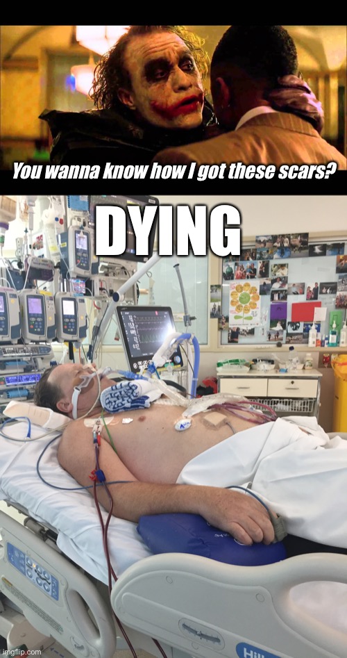 Scars | You wanna know how I got these scars? DYING | image tagged in you wanna know how i got these scars,dying | made w/ Imgflip meme maker
