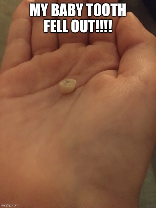 My baby tooth fell out!!!!! |  MY BABY TOOTH FELL OUT!!!! | image tagged in toothless,baby tooth,memes | made w/ Imgflip meme maker