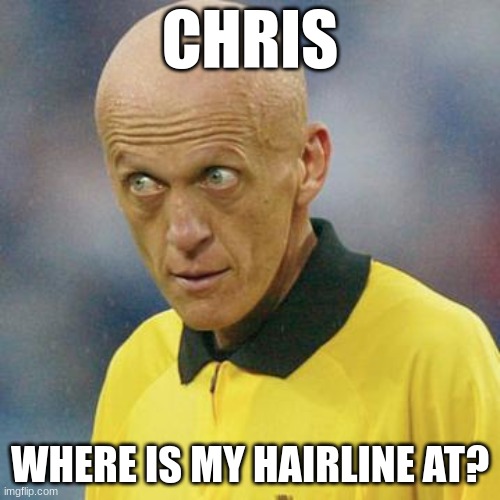 Where? | CHRIS; WHERE IS MY HAIRLINE AT? | image tagged in are you serious football | made w/ Imgflip meme maker