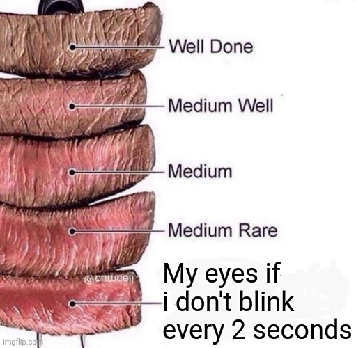 So true | M; My eyes if i don't blink every 2 seconds | image tagged in really rare | made w/ Imgflip meme maker