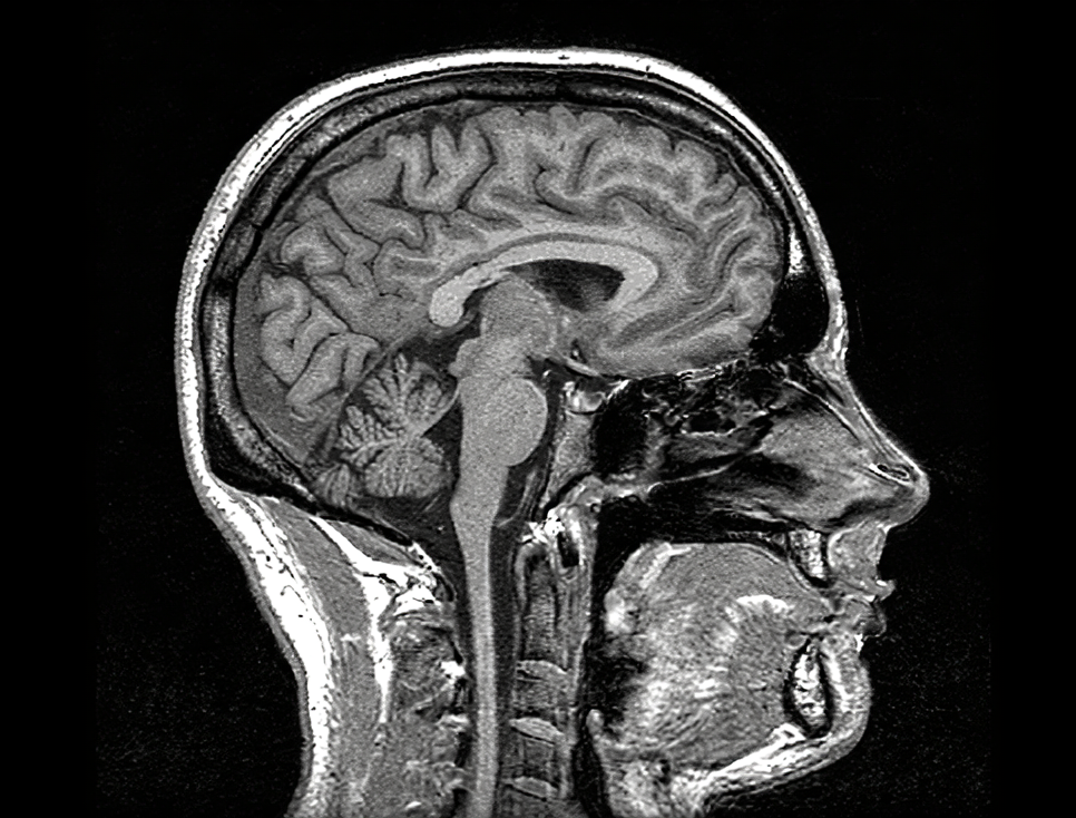 Brainscan Blank Meme Template