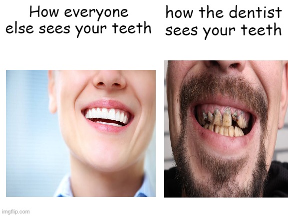 i dont know if this is only me | How everyone else sees your teeth; how the dentist sees your teeth | image tagged in idk about tags | made w/ Imgflip meme maker