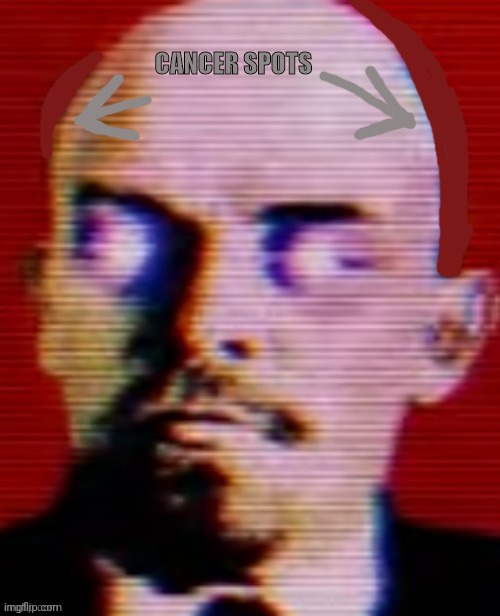 CANCER SPOTS | made w/ Imgflip meme maker