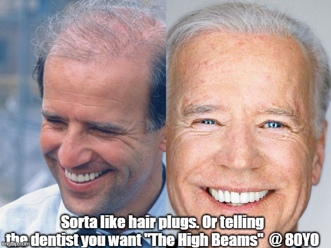 Sorta like hair plugs. Or telling the dentist you want "The High Beams"  @ 80YO | made w/ Imgflip meme maker