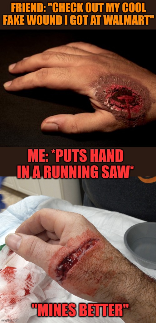 MY SAW SPRING AT WORK BROKE TODAY. GOT 11 STITCHES. | FRIEND: "CHECK OUT MY COOL FAKE WOUND I GOT AT WALMART"; ME: *PUTS HAND IN A RUNNING SAW*; "MINES BETTER" | image tagged in wound,halloween,spooktober | made w/ Imgflip meme maker