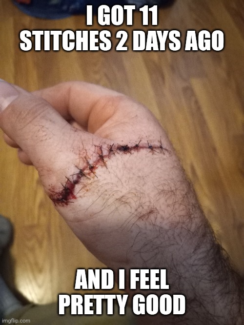 I GOT 11 STITCHES 2 DAYS AGO AND I FEEL PRETTY GOOD | made w/ Imgflip meme maker