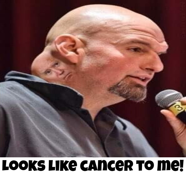 Now you know why we call him Festerneck | Looks like cancer to me! | image tagged in john fetterman,uncle fester,cancerous,tumor,growth,nuke it | made w/ Imgflip meme maker