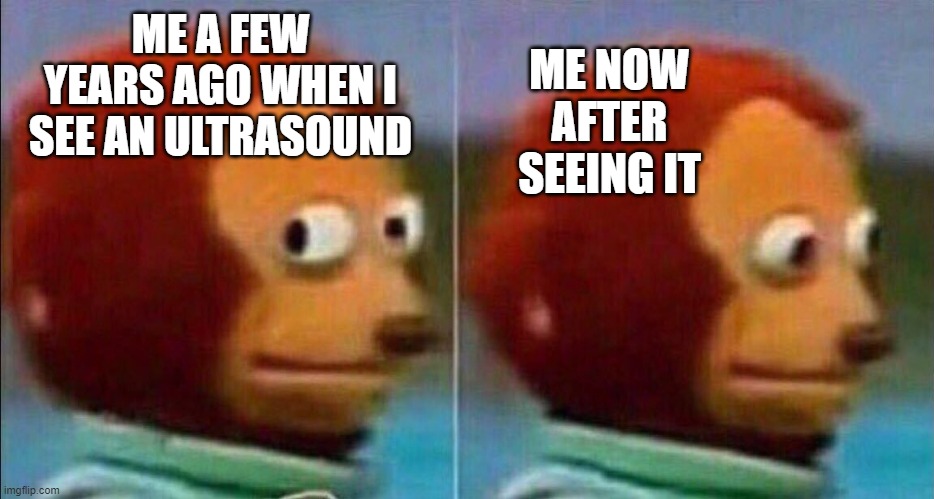 Ultrasound momento | ME NOW AFTER SEEING IT; ME A FEW YEARS AGO WHEN I SEE AN ULTRASOUND | image tagged in monkey looking away | made w/ Imgflip meme maker