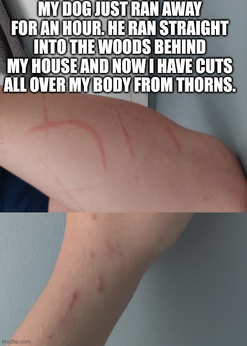 MY DOG JUST RAN AWAY FOR AN HOUR. HE RAN STRAIGHT INTO THE WOODS BEHIND MY HOUSE AND NOW I HAVE CUTS ALL OVER MY BODY FROM THORNS. | made w/ Imgflip meme maker