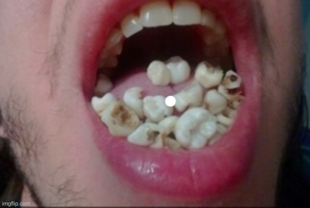 teeth corn | image tagged in teeth,corn | made w/ Imgflip meme maker