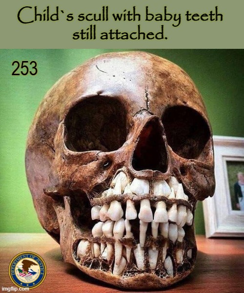 Exhibit No. 253 | Child`s scull with baby teeth
still attached. 253 | image tagged in skull | made w/ Imgflip meme maker