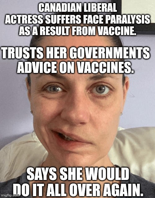 CANADIAN LIBERAL ACTRESS SUFFERS FACE PARALYSIS AS A RESULT FROM VACCINE. TRUSTS HER GOVERNMENTS ADVICE ON VACCINES. SAYS SHE WOULD DO IT AL | made w/ Imgflip meme maker