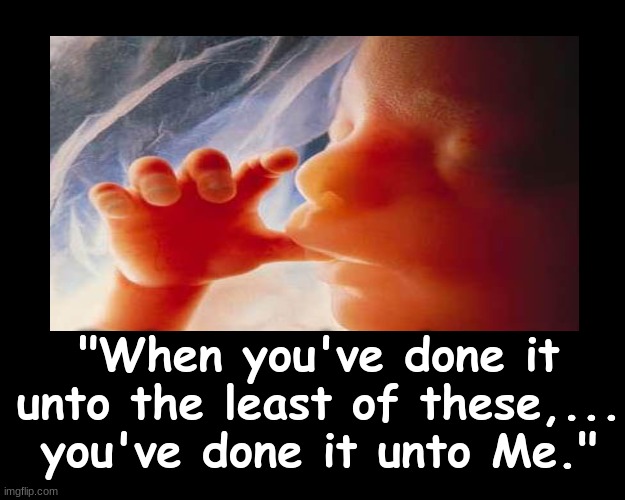 "WHEN YOU'VE DONE IT UNTO THE LEAST OF THESE, YOU'VE DONE IT UNTO ME.." | "When you've done it unto the least of these,... you've done it unto Me." | image tagged in baby,jesus christ | made w/ Imgflip meme maker