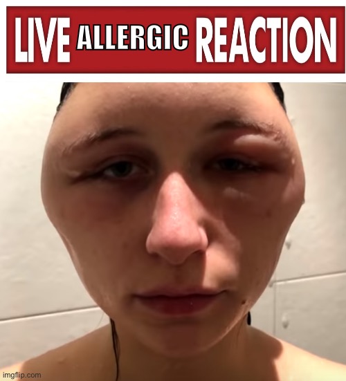 ALLERGIC | made w/ Imgflip meme maker