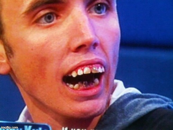 British Teeth  | image tagged in british teeth | made w/ Imgflip meme maker