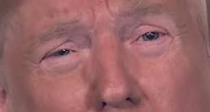 High Quality Trump dilated and in tears 'cause he's sick and tired of winning Blank Meme Template