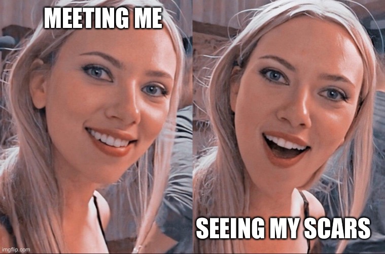 Scars | MEETING ME; SEEING MY SCARS | image tagged in surprised scarlett johansson,scar,body | made w/ Imgflip meme maker