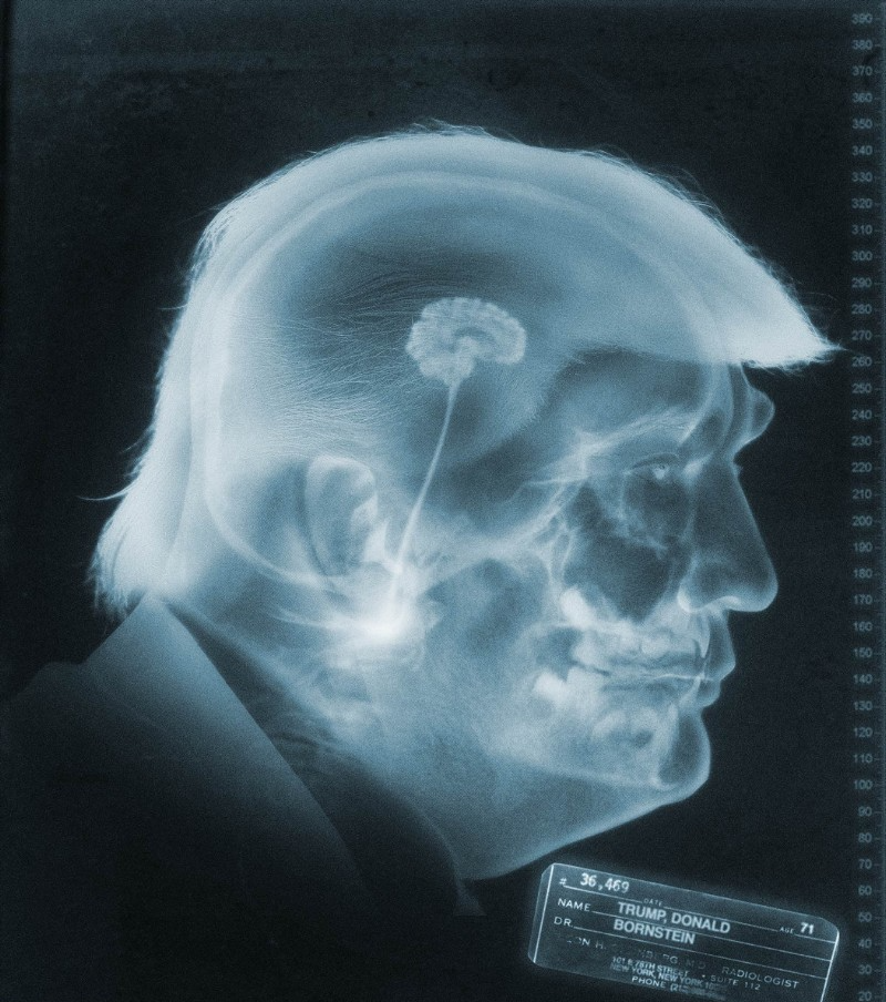 Trump small brain  Treason Idiot Republican Nazi Traitor Blank Meme Template