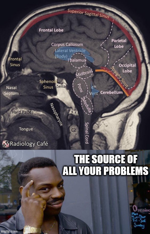 THE SOURCE OF ALL YOUR PROBLEMS | image tagged in fact,memes,roll safe think about it | made w/ Imgflip meme maker