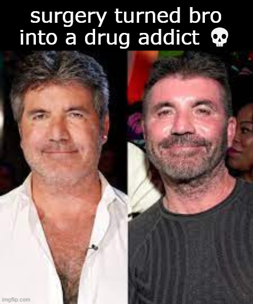 he boutta live the same life as Michael | surgery turned bro into a drug addict 💀 | image tagged in simon cowell | made w/ Imgflip meme maker
