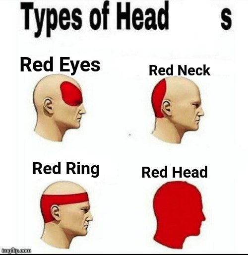 Not how to use this template #11 | Red Eyes; Red Neck; Red Ring; Red Head | image tagged in types of headaches meme | made w/ Imgflip meme maker