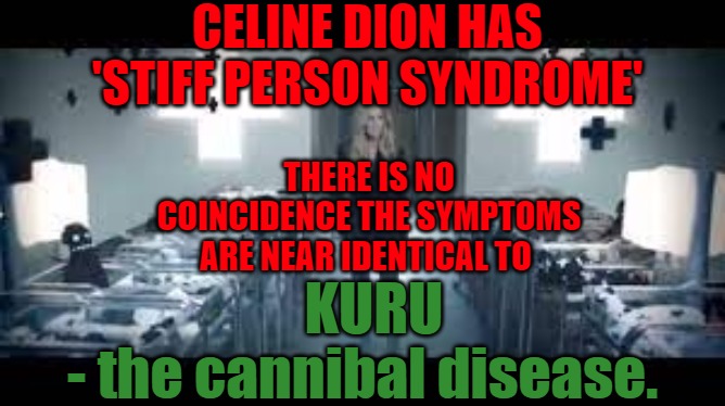 Celine Dion | CELINE DION HAS 'STIFF PERSON SYNDROME'; THERE IS NO COINCIDENCE THE SYMPTOMS ARE NEAR IDENTICAL TO; KURU
- the cannibal disease. | image tagged in celine dion,disease,kuru,adrenochrome,sick | made w/ Imgflip meme maker