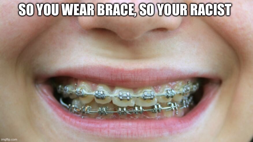 Braces | SO YOU WEAR BRACE, SO YOUR RACIST | image tagged in braces | made w/ Imgflip meme maker