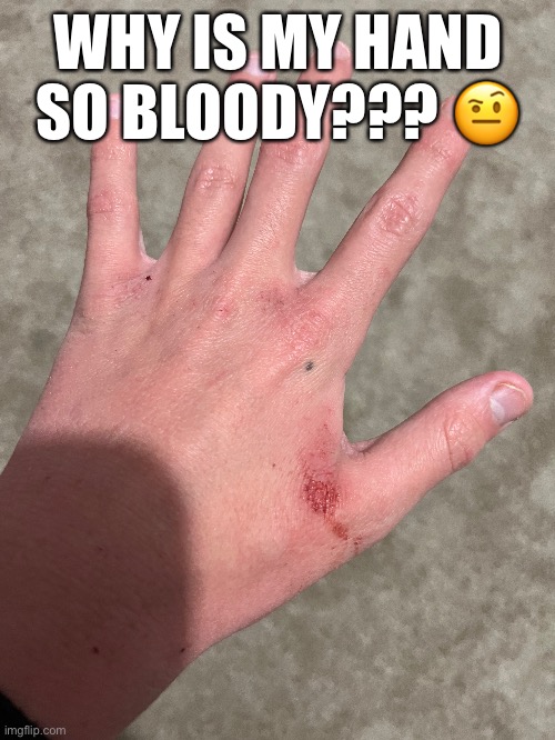 I think my hands have gotten too dry (no lotion) and now it’s cracking and bleeding | WHY IS MY HAND SO BLOODY??? 🤨 | made w/ Imgflip meme maker