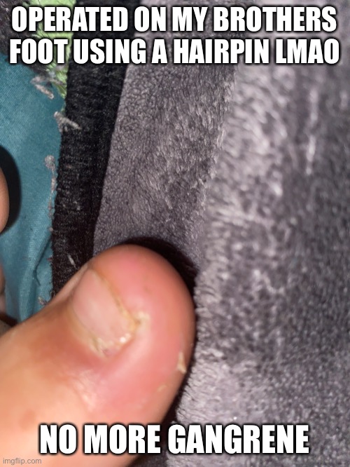 Also, Brother’s foot reveal | OPERATED ON MY BROTHERS FOOT USING A HAIRPIN LMAO; NO MORE GANGRENE | image tagged in balls,no context | made w/ Imgflip meme maker