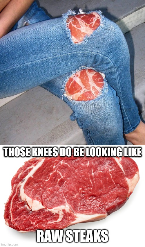 Cursed knees | THOSE KNEES DO BE LOOKING LIKE; RAW STEAKS | image tagged in meat raw,cursed,knees,cursed image,memes,knee | made w/ Imgflip meme maker